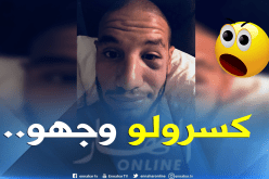“قديورة” يتعرض لكسر في الوجنة ويُطمئن مُحبيه!