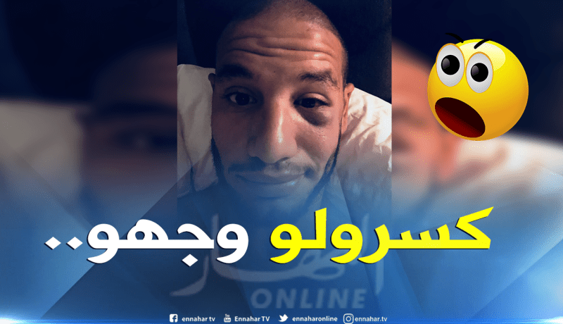 “قديورة” يتعرض لكسر في الوجنة ويُطمئن مُحبيه!