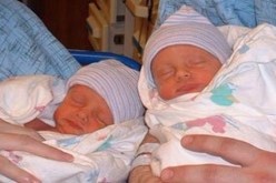حالة نادرة .. ولادة توأم بفارق 42 يوما