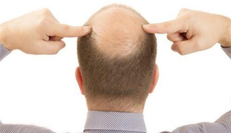 الفئران للقضاء على الصلع!!