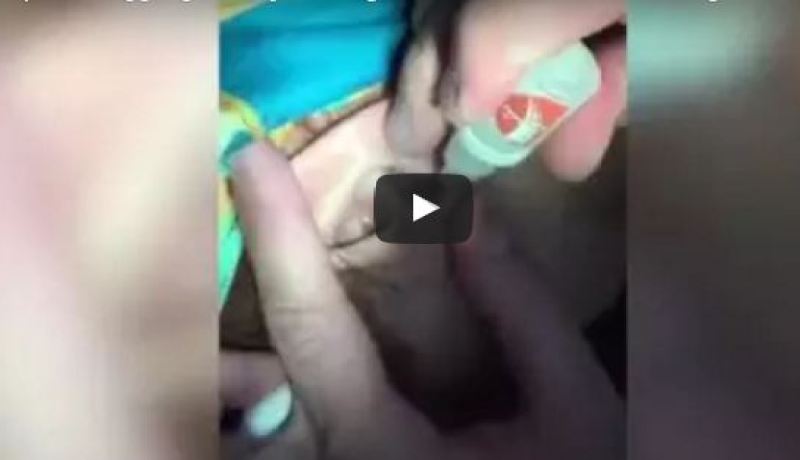 بالفيديو.. شاهد ماذا يخرج من أذن فتاة