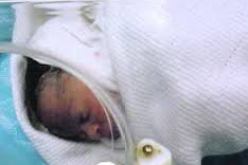 مختصون يدعون إلى استعمال الجراحة بالمنظار للتكفل بالتشوهات الخلقية لدى الجنين