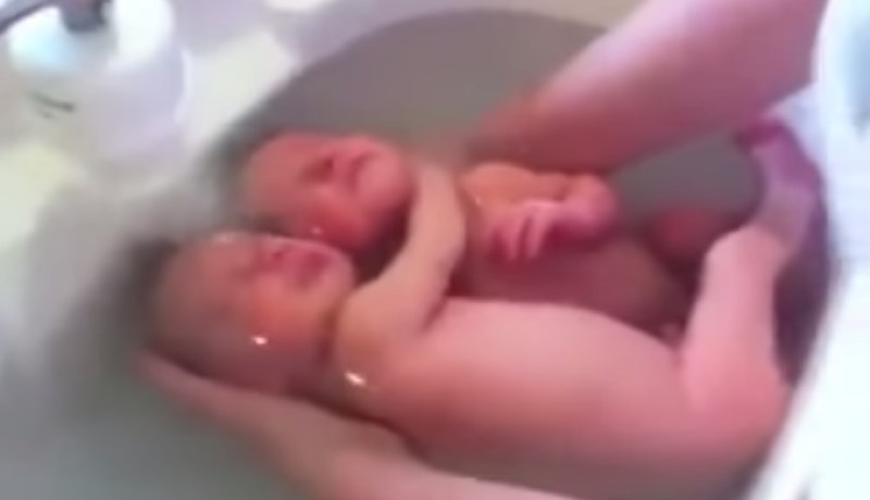 لقطة في منتهى الجمال لتوأم بعد خروجه من بطن أمه