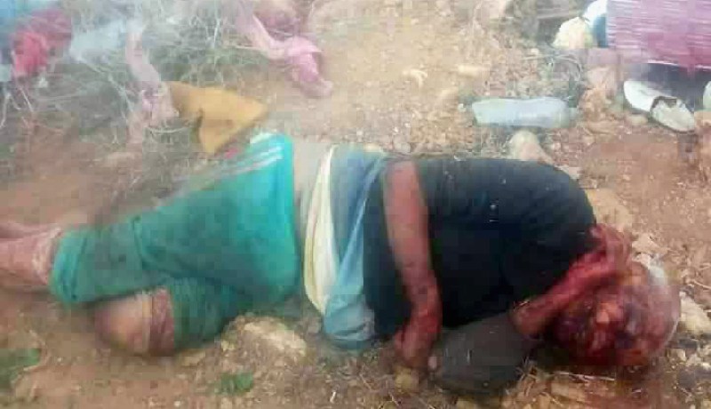 بالصور.. إعتداء وحشي على مشرد طاعن في السن بوهران