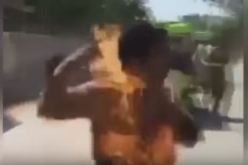 بالفيديو احتراق رجل بسبب بطارية هاتفه النقال
