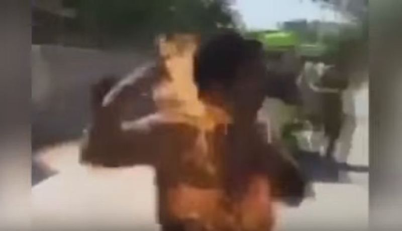 بالفيديو احتراق رجل بسبب بطارية هاتفه النقال