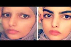 فتاة تثير الجدل بحلاقة حاجبيها بعد أيّام من تعرّضها للضّرب في لندن