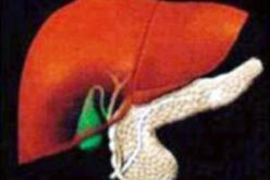 فريق مصري يتوصل إلى اختبار أسرع واقل كلفة لفيروس التهاب الكبد الوبائي سي