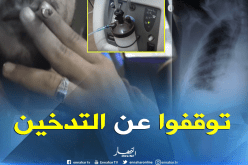 5 بالمائة من الجزائريين مصابون بالإنسداد الرئوي