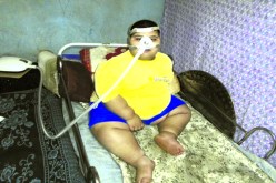 طفل من سطيف عمره 7 سنوات ويزن أكثر من قنطار و10كلغ