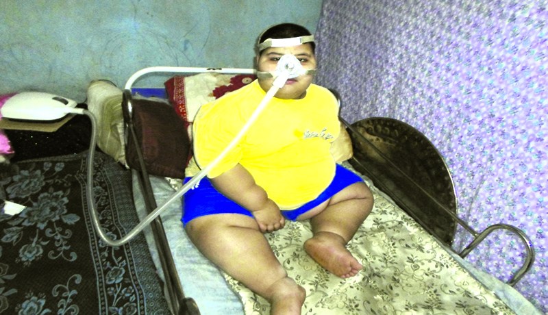 طفل من سطيف عمره 7 سنوات ويزن أكثر من قنطار و10كلغ