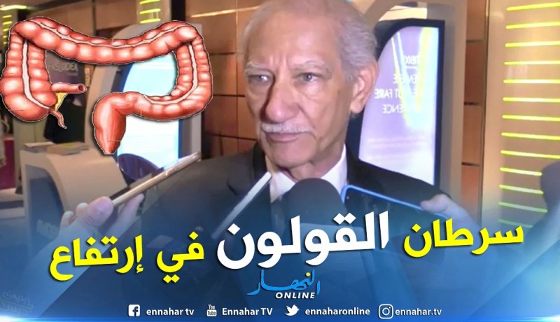 البروفيسور زيتوني: إرتفاع حالات الإصابة بسرطان القولون وهناك علاج مبتكر له