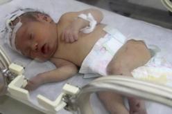 رضيعة تعود للحياة بعد ساعتين من دفنها