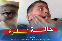 بالصور.. قطع ورقية تخرج من عين التلميذ صالح بمسكيانة في أم البواقي