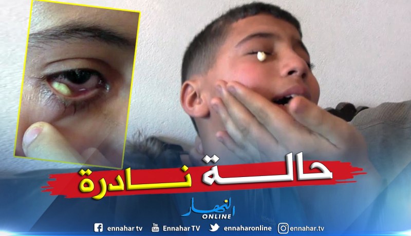 بالصور.. قطع ورقية تخرج من عين التلميذ صالح بمسكيانة في أم البواقي