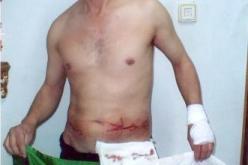 هامل حملاوي يودع ملفا طبيا لدى منظمة حقوق الإنسان يقرر مقاضاة الرئيس حسني مبارك