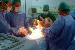 40 بالمائة من الولادات بالجزائر تتم عبر عمليات قيصرية