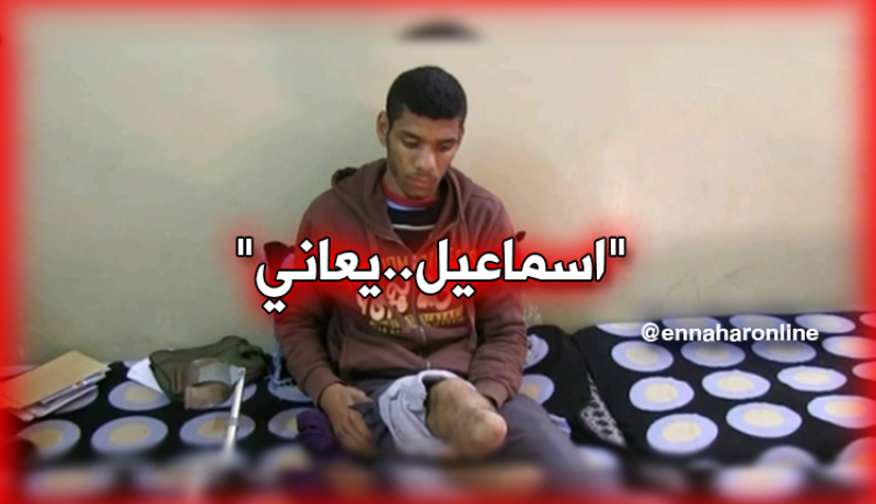 المرض ينهش كامل جسد اسماعيل