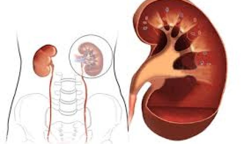 سلال يلح على بناء شراكة مع مختصين أجانب في ميدان البحث في أمراض الكلى و المسالك البولية