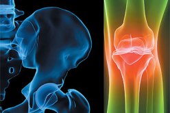 السائل الطافي فوق الحليب الرائب أو الياوورت فعال ضد مرض هشاشة العظام