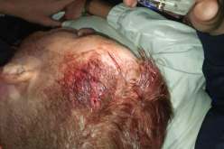 بالصور .. إصابات لـ”الشناوة” بعد رشقهم بالحجارة في وهران