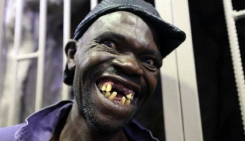 عراك على  الرجل الأقبح  في زيمبابوي