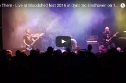 بالفيديو.. مطرب يستمر في الغناء بعد كسر ساقيه أثناء حفل