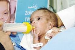 إجراء أول عملية ناجحة لإستبدال مفصل الركبة بمستشفى النعامة