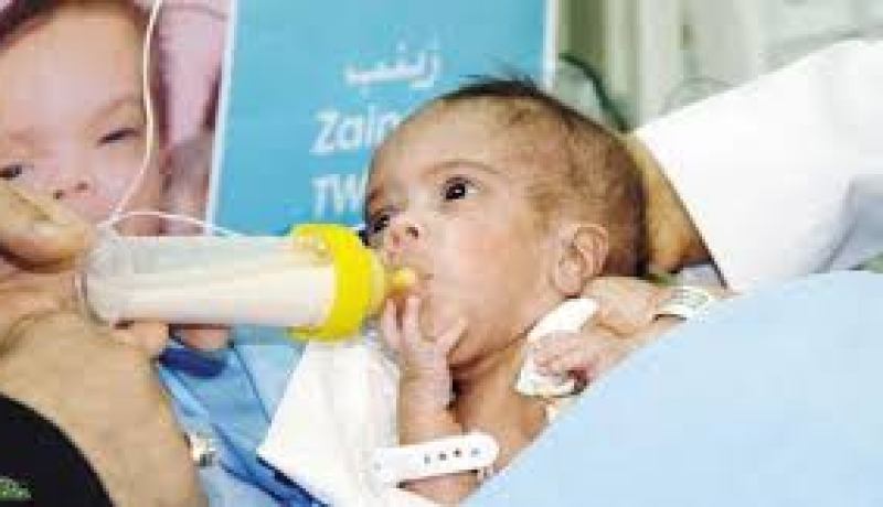 إجراء أول عملية ناجحة لإستبدال مفصل الركبة بمستشفى النعامة