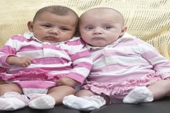 توأمين مختلفين لأب جامايكي وأم بريطانية