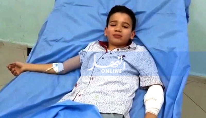 قضيب حديدي يخترق يد طفل يجتاز السانكيام بالبليدة