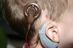 طفلة تستعيد السمع والنطق بعد عملية لزرع قوقعة الأذن في وهران