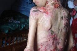 النهار تنقل أنين عائلة أنهكها الفقر ومرض غريب يحول براعمها إلى  أسرى في سوق أهراس