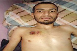 أسرة كرة القـدم تتضامن مع مريض وترفع شعار كلنا عدلان في الملاعب الجزائرية