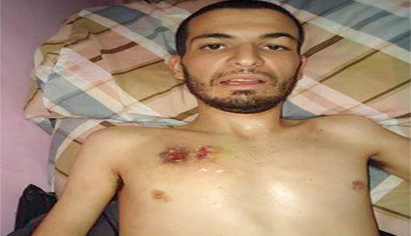 وزير الشباب عبد القادر خمري يصل لمنزل عدلان و يأكد أن الحكومة ستتكفل به رسميا