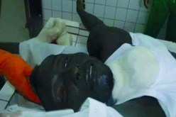 الكـاميرونيــــون يســـرّبـــون صــــورا صــادمة لجثـة إيبـــوســـي بعـد عملــيــة التشــــريــــح