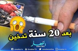 بالفيديو.. مقارنة بين رئة سليمة وأخرى بعد 20 سنة من التدخين؟!