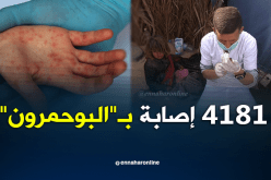 تسجيل 4181 حالة إصابة بـ”البوحمرون” على المستوى الوطني