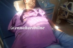 مجهولون يحرقون فيلا و5 سيارات ويشجون رأس الحارس بـ«شاقور» على الرأس في براقي !