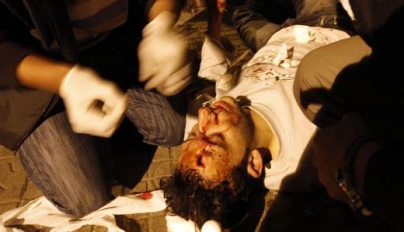 مصر: أكثر من 100 مصاب في اشتباكات بميدان التحرير في جمعة  كشف الحساب
