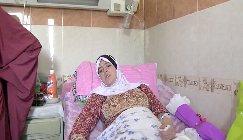 إبتسام ضحية أطباء تركوا ضمادة خلف عضلة قلبها منذ 15 سنة في خنشلة