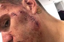 “مورايس” يكشف ما فعله به “ماني”