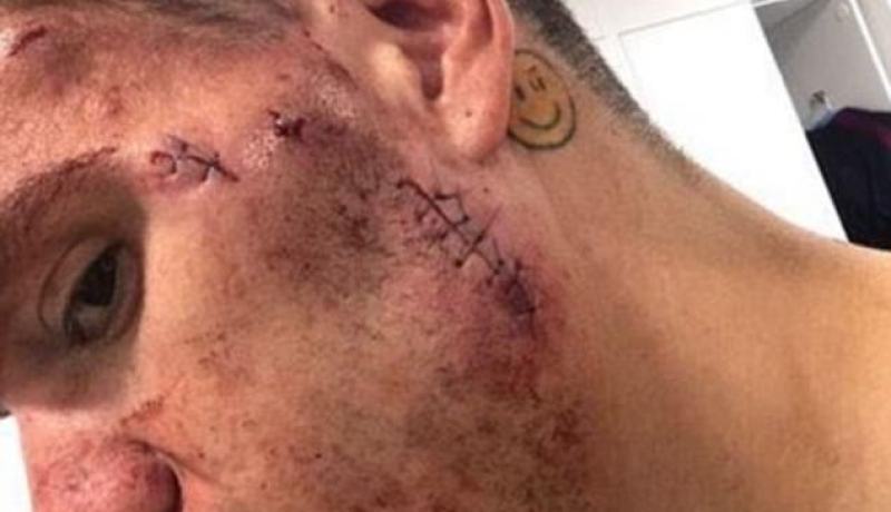 “مورايس” يكشف ما فعله به “ماني”