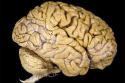 التوصل الى تصميم نموذج  جديد يساهم في اظهار الصور المختزنة في دماغ الانسان