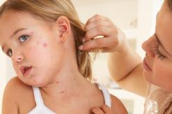 أرقام مخيفة لانتشار مرض الحصبة في أوروبا