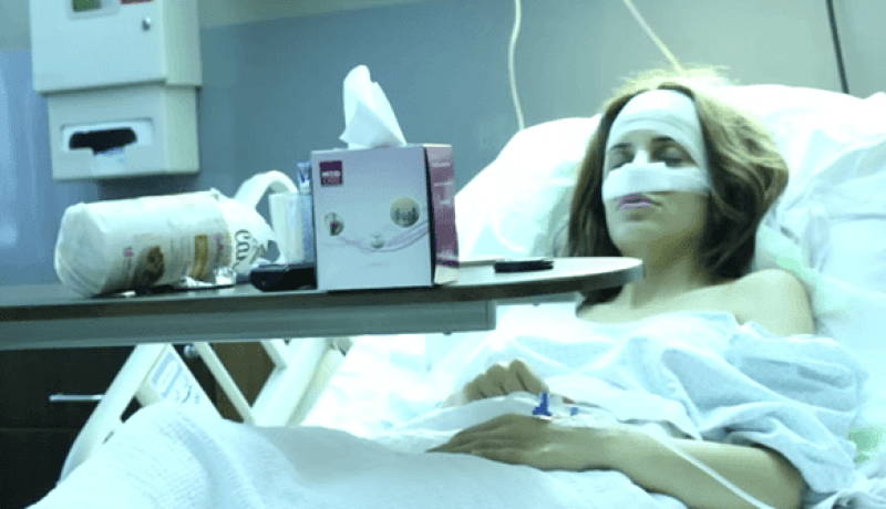 دومينيك حوراني تخضع لجراحة تجميل لأنفها مباشرة على الهواء
