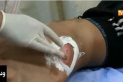 هذا ما شهدته إستعجالات المستشفيات عشية الإحتفال بالمولد النبوي الشريف