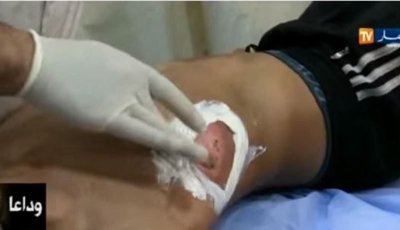 هذا ما شهدته إستعجالات المستشفيات عشية الإحتفال بالمولد النبوي الشريف