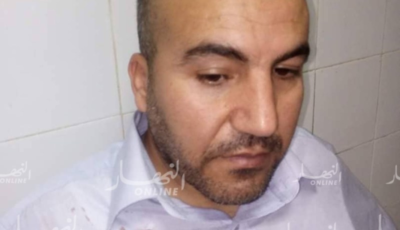 طالب يعتدي على أستاذ بآلة حادة بتبسة
