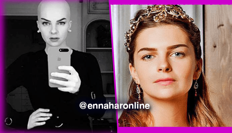 الممثلة التّركية بيلين كارهان تفاجئ جمهورها وهي صلعاء